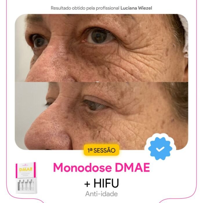 Antes e depois2 Antes e depois2