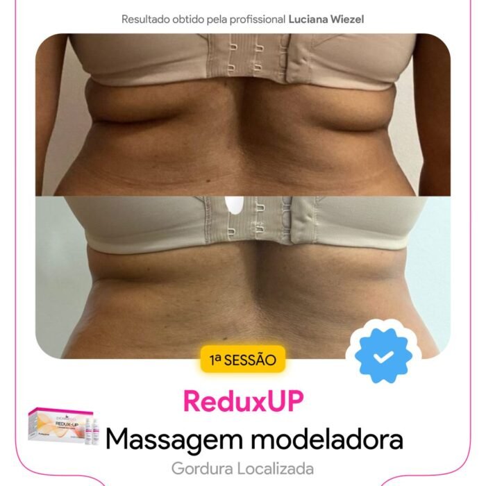 Antes e depois3 Antes e depois3