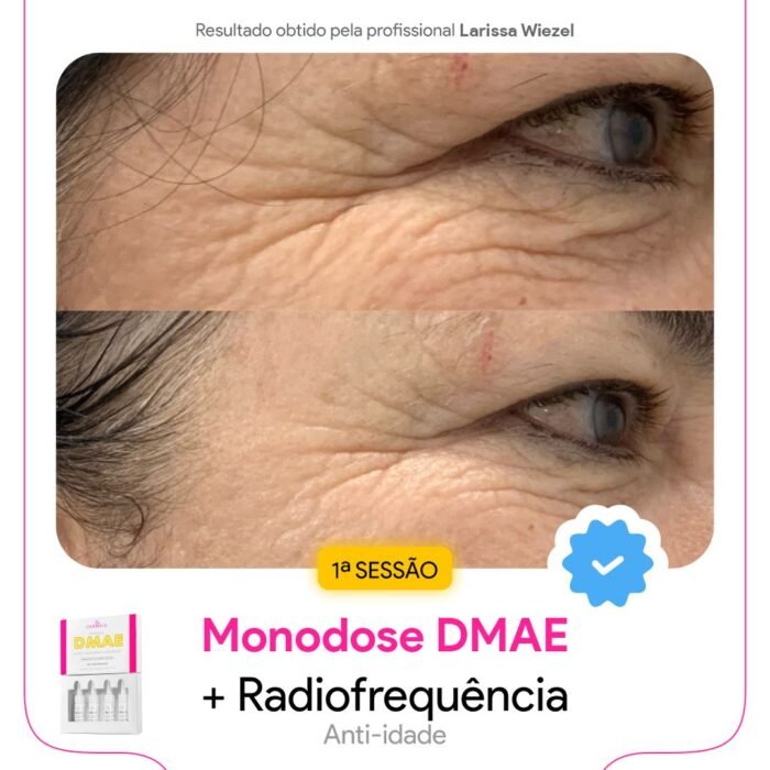 Antes e depois4 Antes e depois4