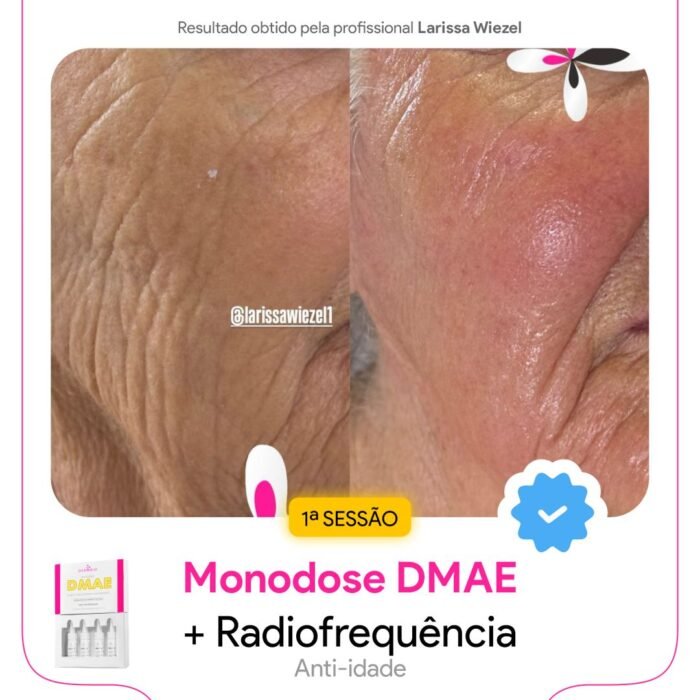 Antes e depois5 Antes e depois5