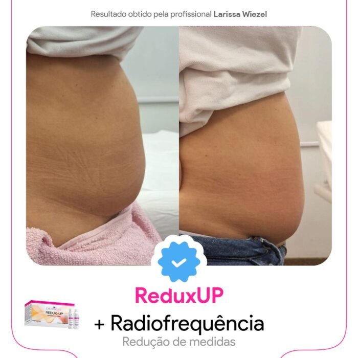 Antes e depois6 Antes e depois6