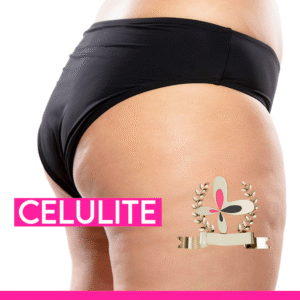 Curso de celulite