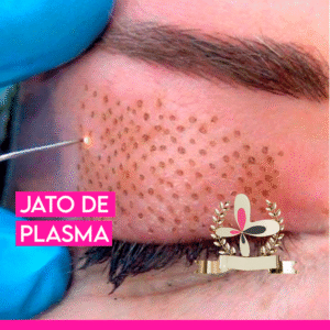 Curso de Jato de plasma