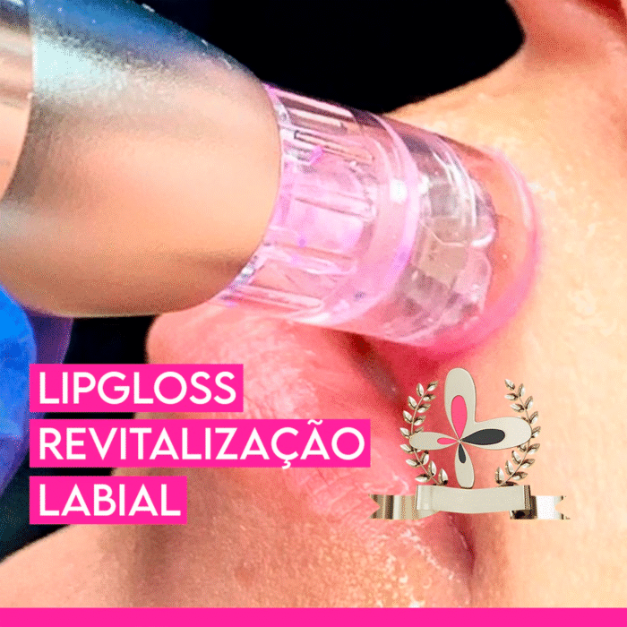 LPG
