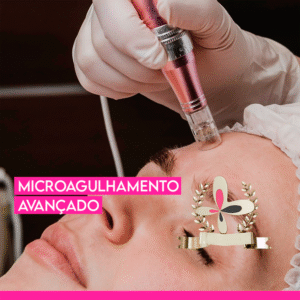 Curso de Microagulhamento