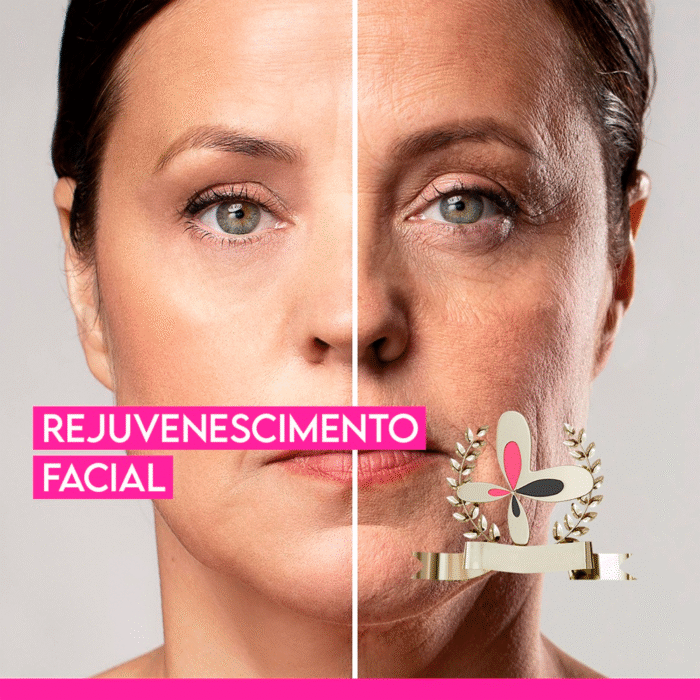 RJVS