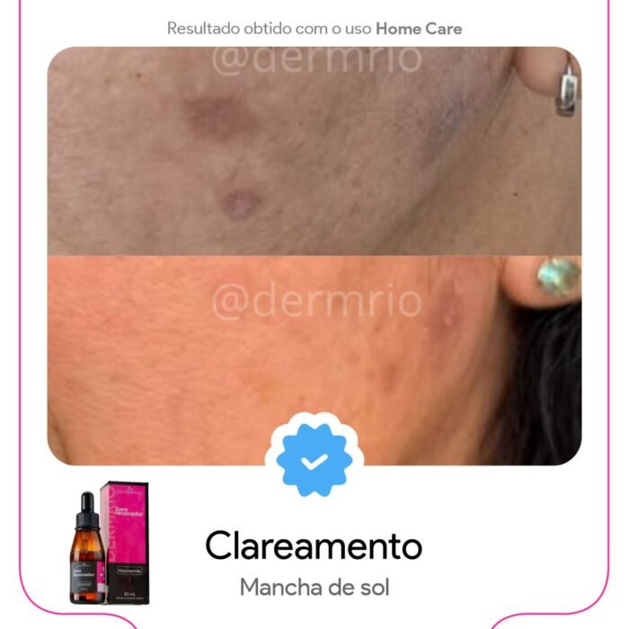 SoroRenovador