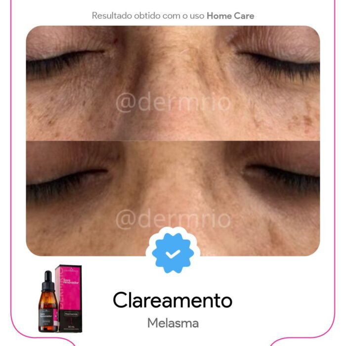 SoroRenovador_1