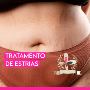 Curso de tratamento de estrias
