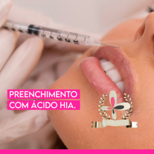 Curso de preenchimento