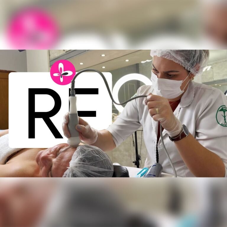 Radiofrequência: benefícios, protocolo e passo a passo do tratamento