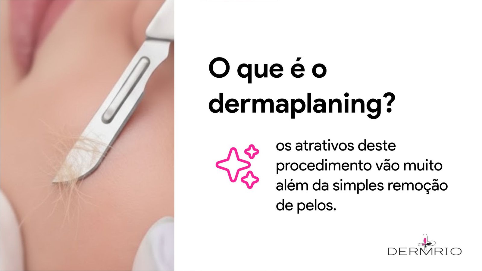 O que é o Dermaplaning? Guia completo – DERMRIO