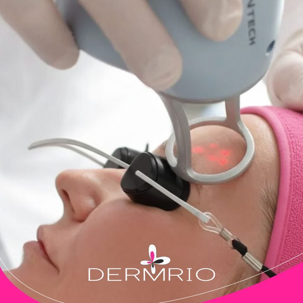 Procedimento facial na Dermrio