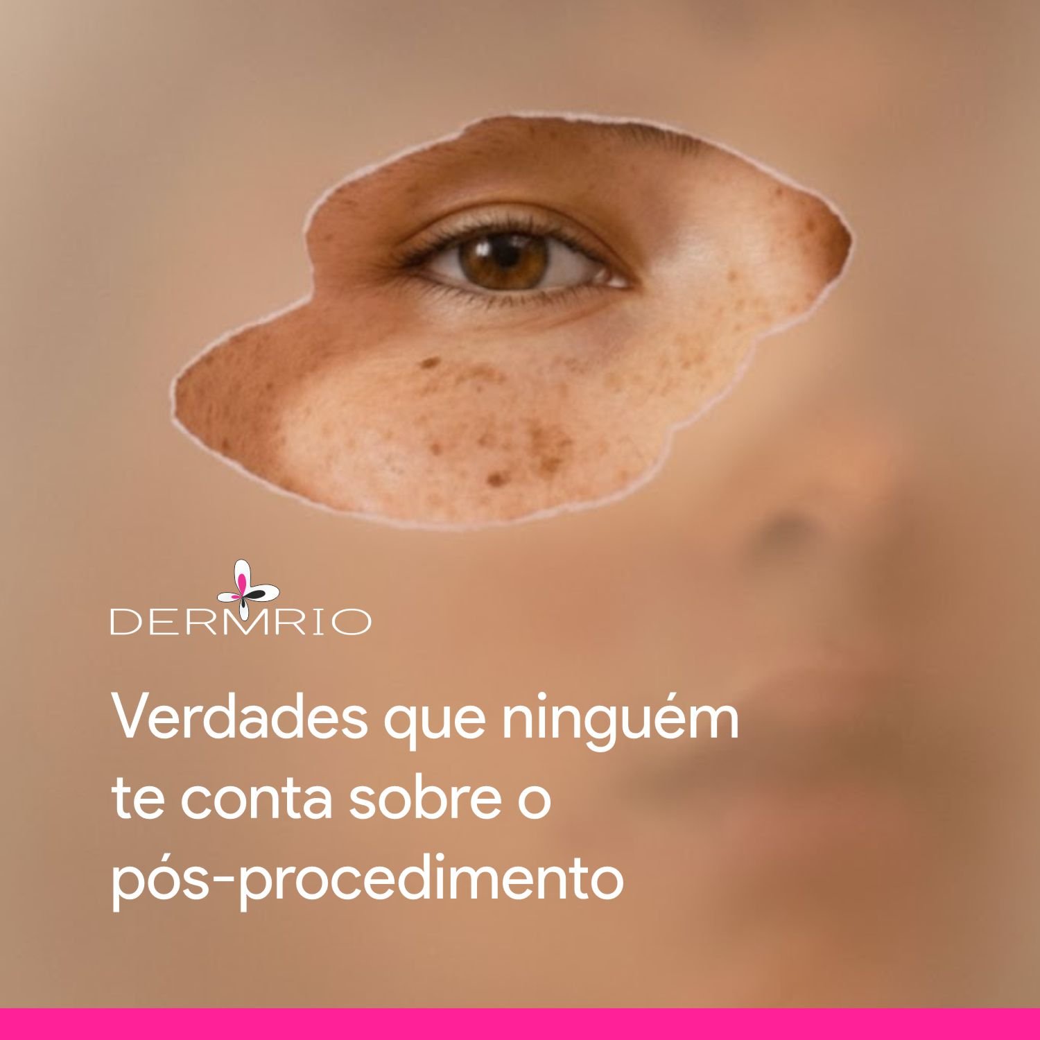 Imagem: Verdade que ninguém te conta sobre o pós procedimento
