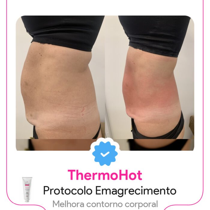 Arte Gerada: ad_thermohot Arte Gerada: ad_thermohot