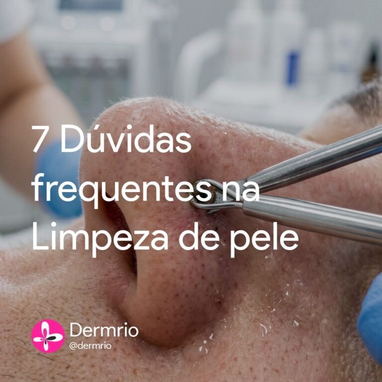 7 Perguntas Frequentes sobre Limpeza de Pele